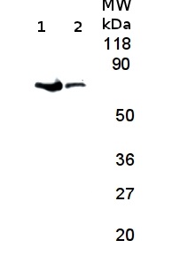 FtsH1-11 | ATP-dependent zinc metalloprotease FtsH1-11 in the group Antibodies Plant/Algal / Global Antibodies at Agrisera AB (Antibodies for research) (AS11 1789)